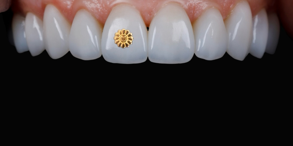 18k Gold Designer Charm