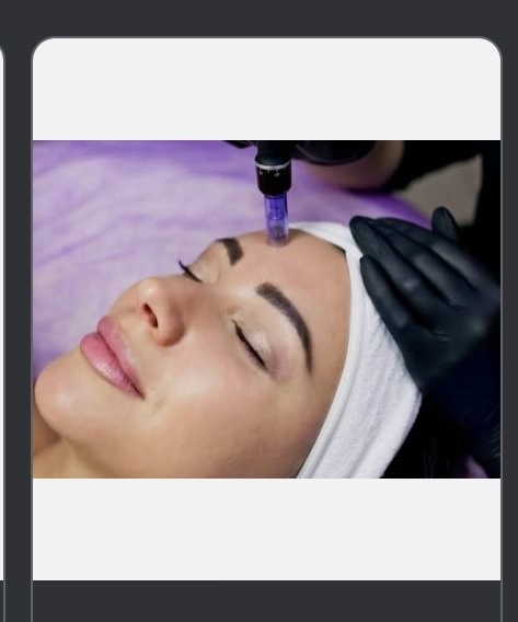 EXPRESS Microneedling