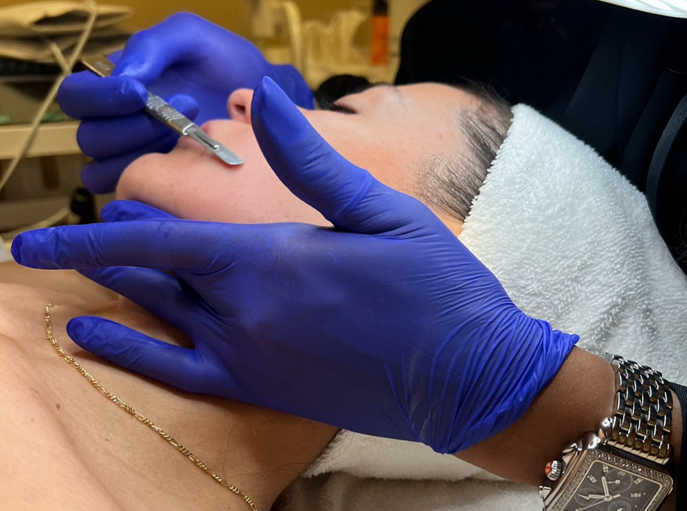 Dermaplaning Facial