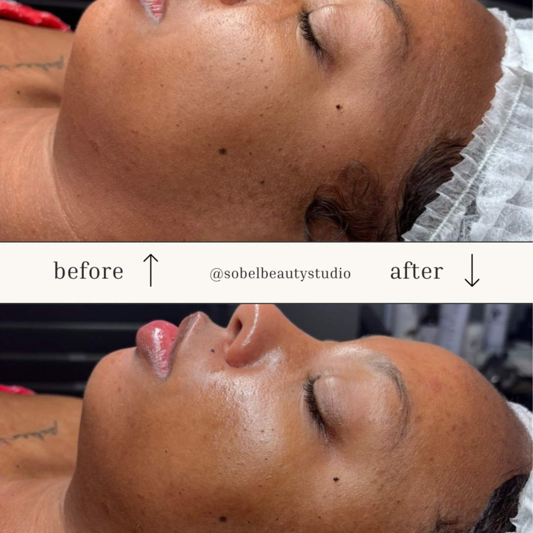 Glass Skin Peptide Facial at So’Bel Beauty Studio in Fort Myers, FL