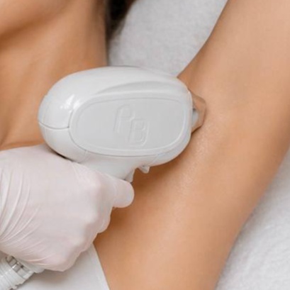 Underarms + Brazilian Bikini Laser at La VILNA in Jacksonville, FL