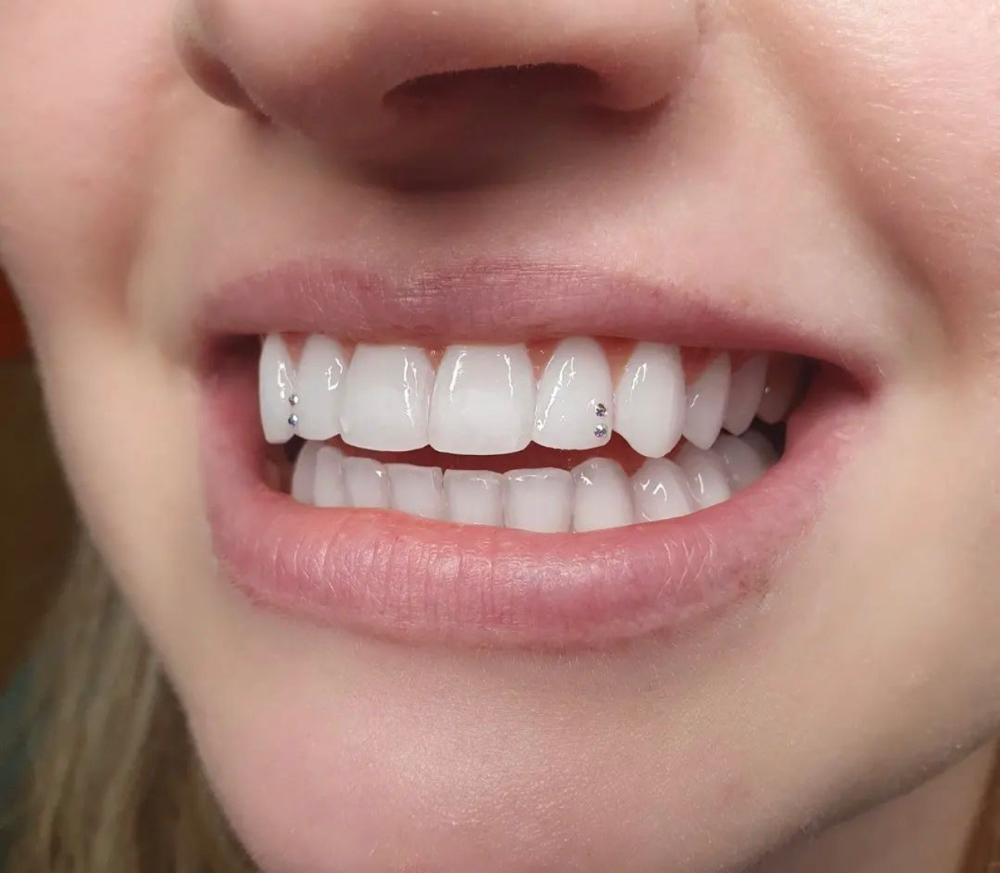 Tooth Gems 1 Tooth (1-4 Gems)
