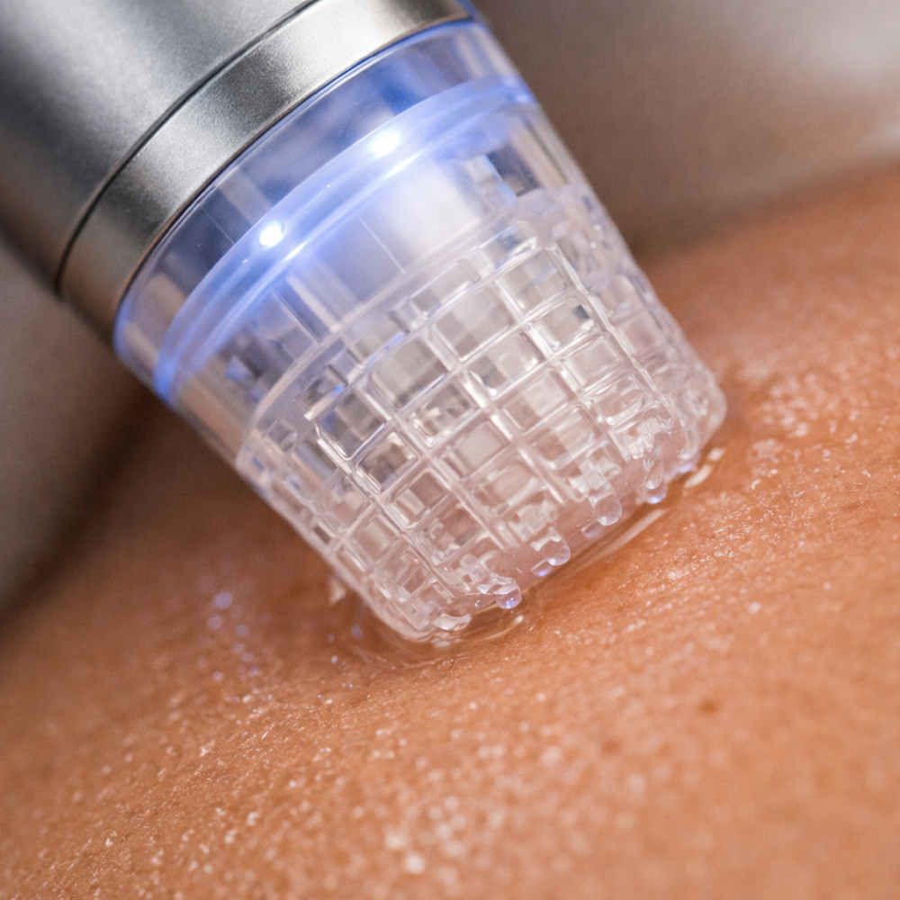 Nano Infusion Facial at Daily SkinTual in California, CA