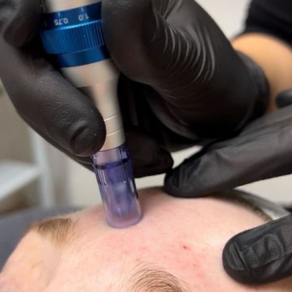 Nano Infusion Body Facial (ADD ON) at Project360 Aesthetics in Pearland, TX