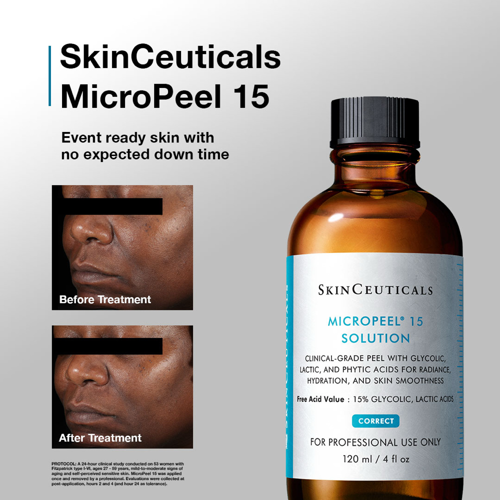 + Add On Glycolic Peel - 15%