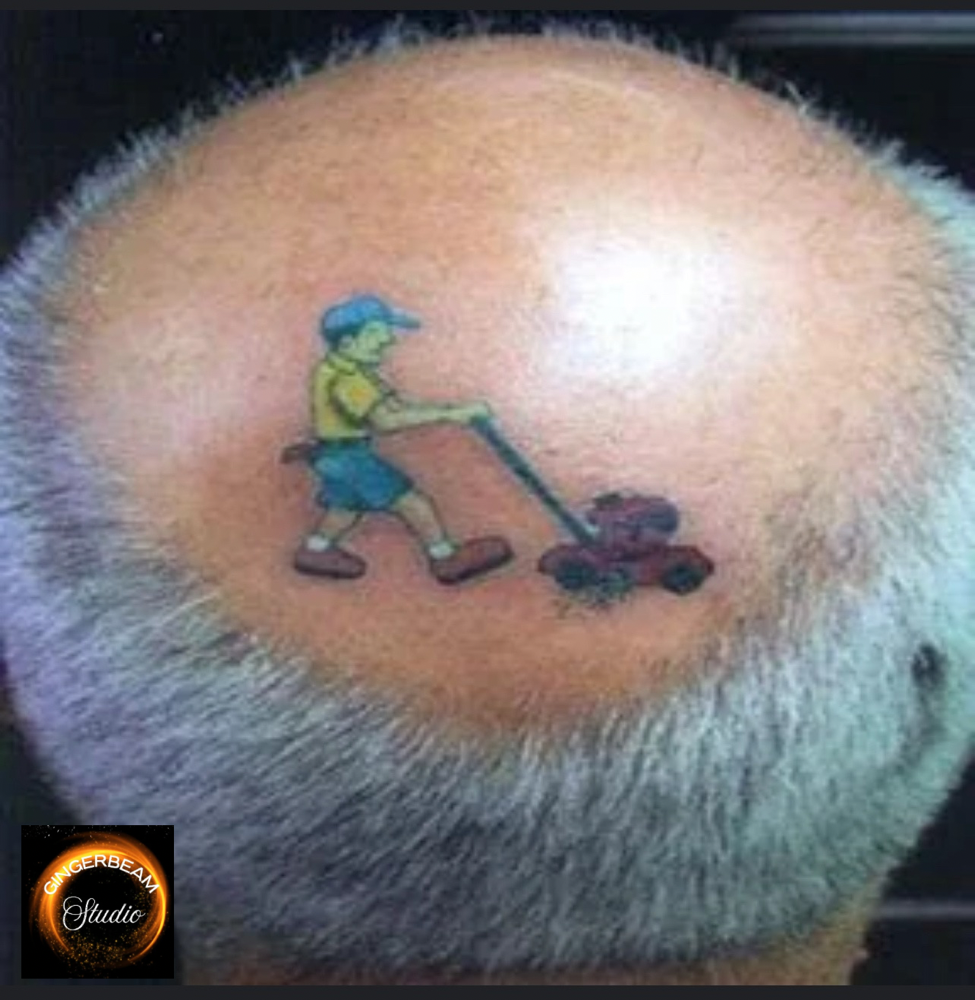 Laser Tattoo Consult