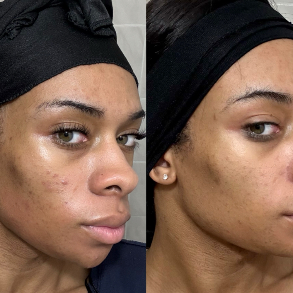 Virtual Consultation at Oasiah Aesthetics in New York, NY