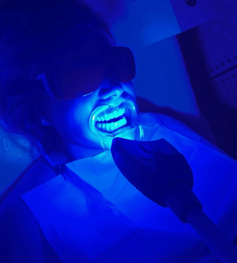 LED Teeth Whitening