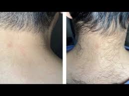 Neck