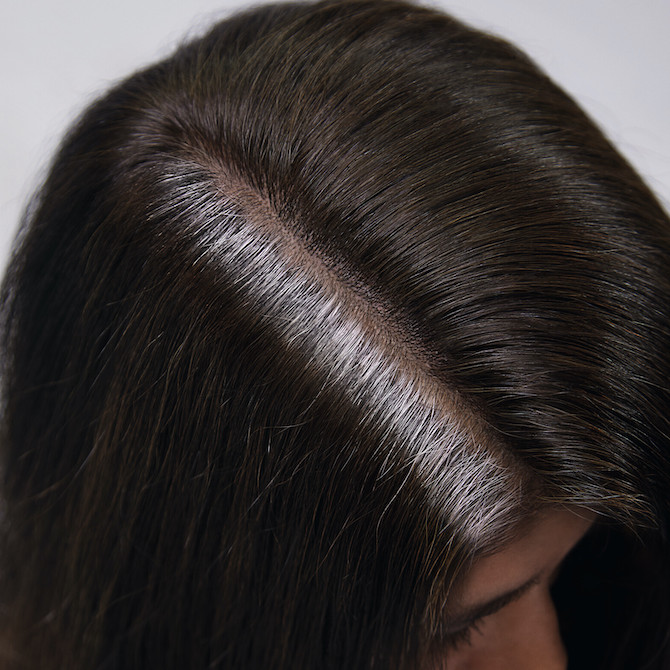 Root Touch-Up