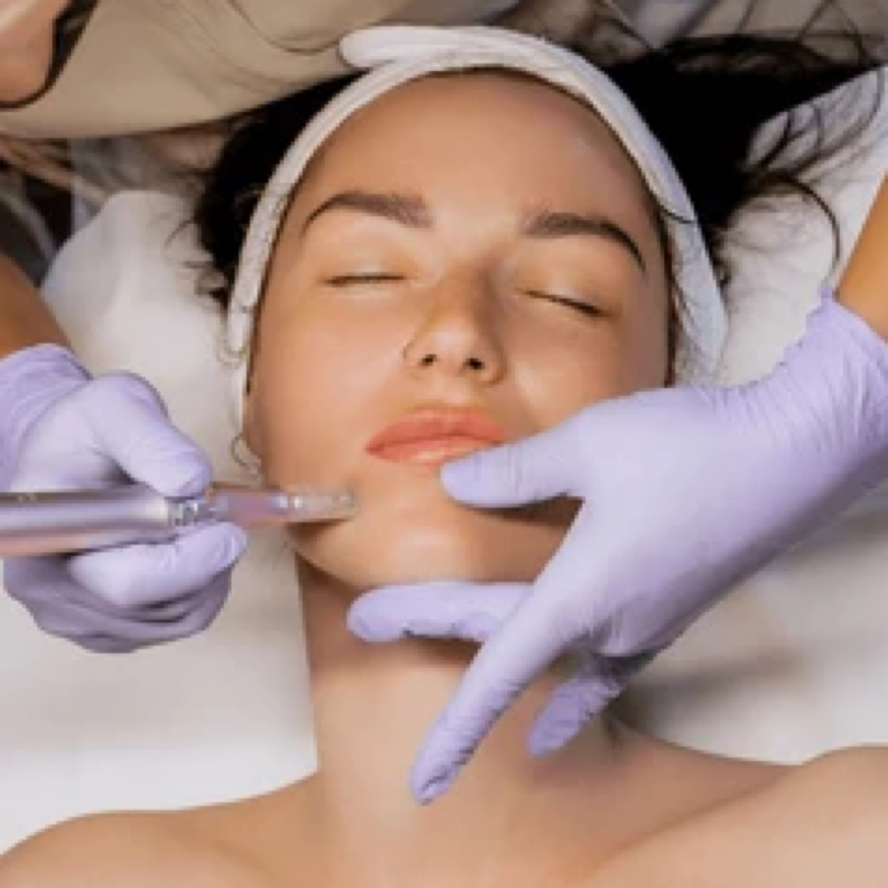 Microneedling with Korean Exosomes at Arch & Glow in Vancouver, WA