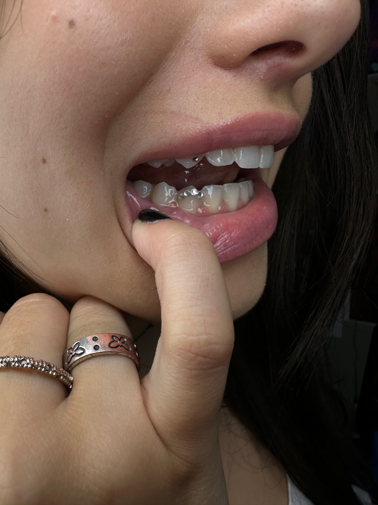Edge Tooth Gems