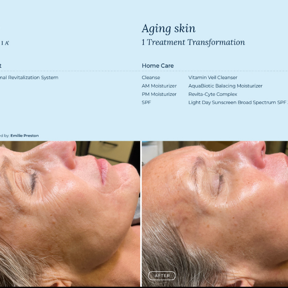 Advanced Rejuvenation Treatment at Melodic Roots & Wellness in Windsor Mill MD, MD