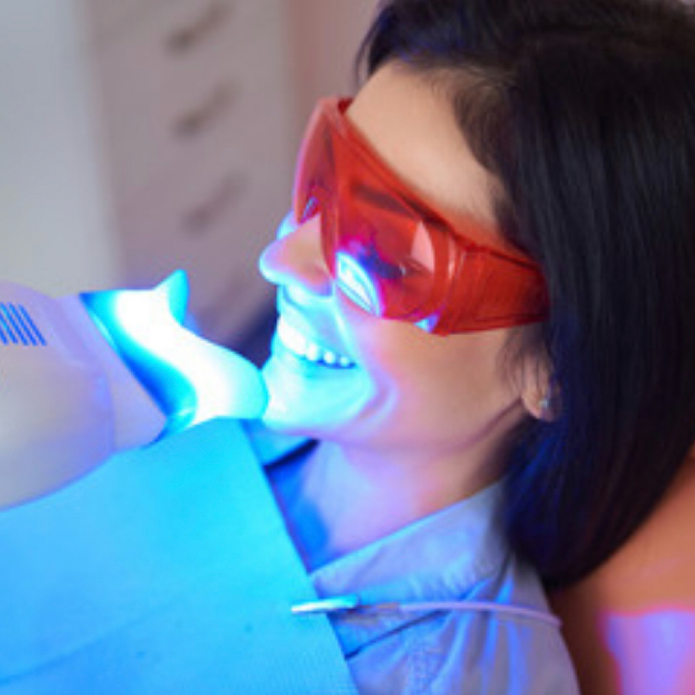 Consultation at Allure Teeth Whitening in Greensboro, NC