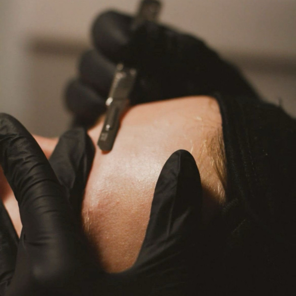 Dermaplaning at NEW Me Skinbar in Rochester, MN