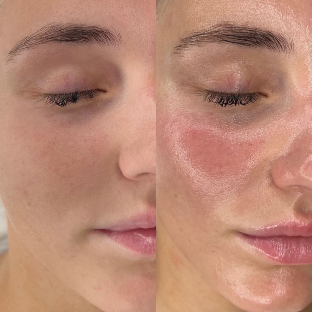 Christina Unstress Facial at Embassy&health&beauty in Hallandale, FL
