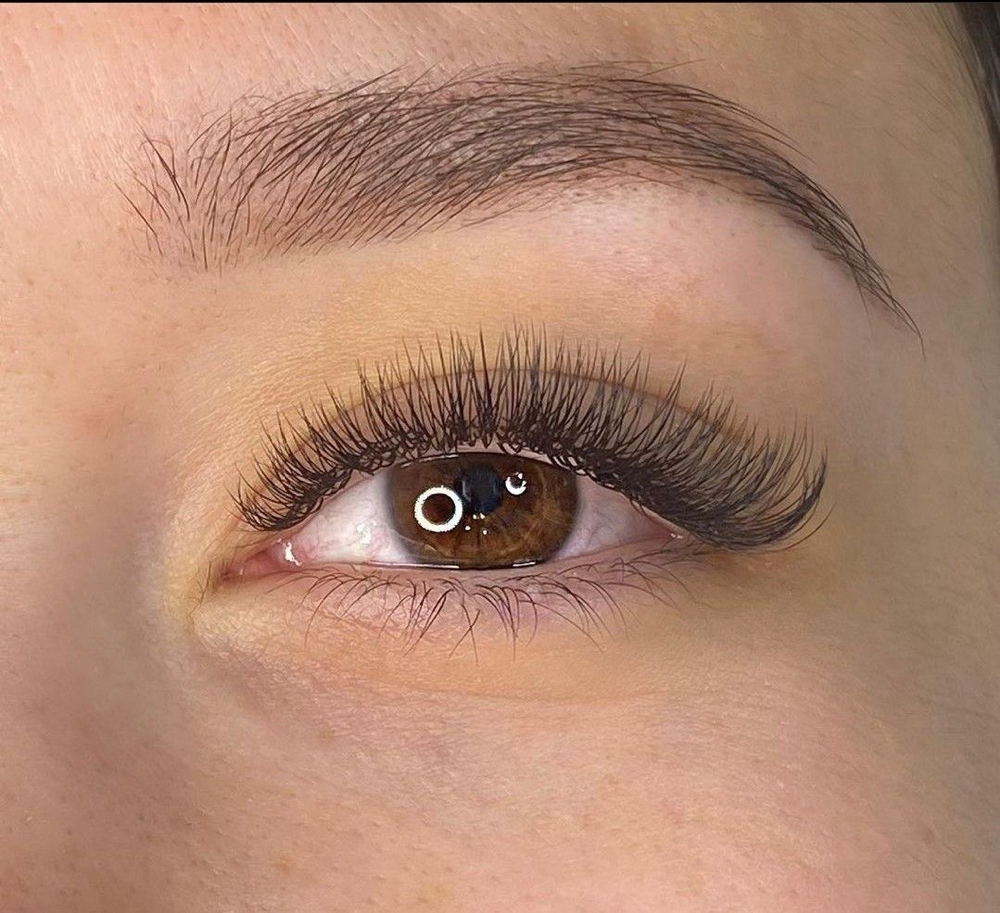 Classic Plus Fill (Retoque)