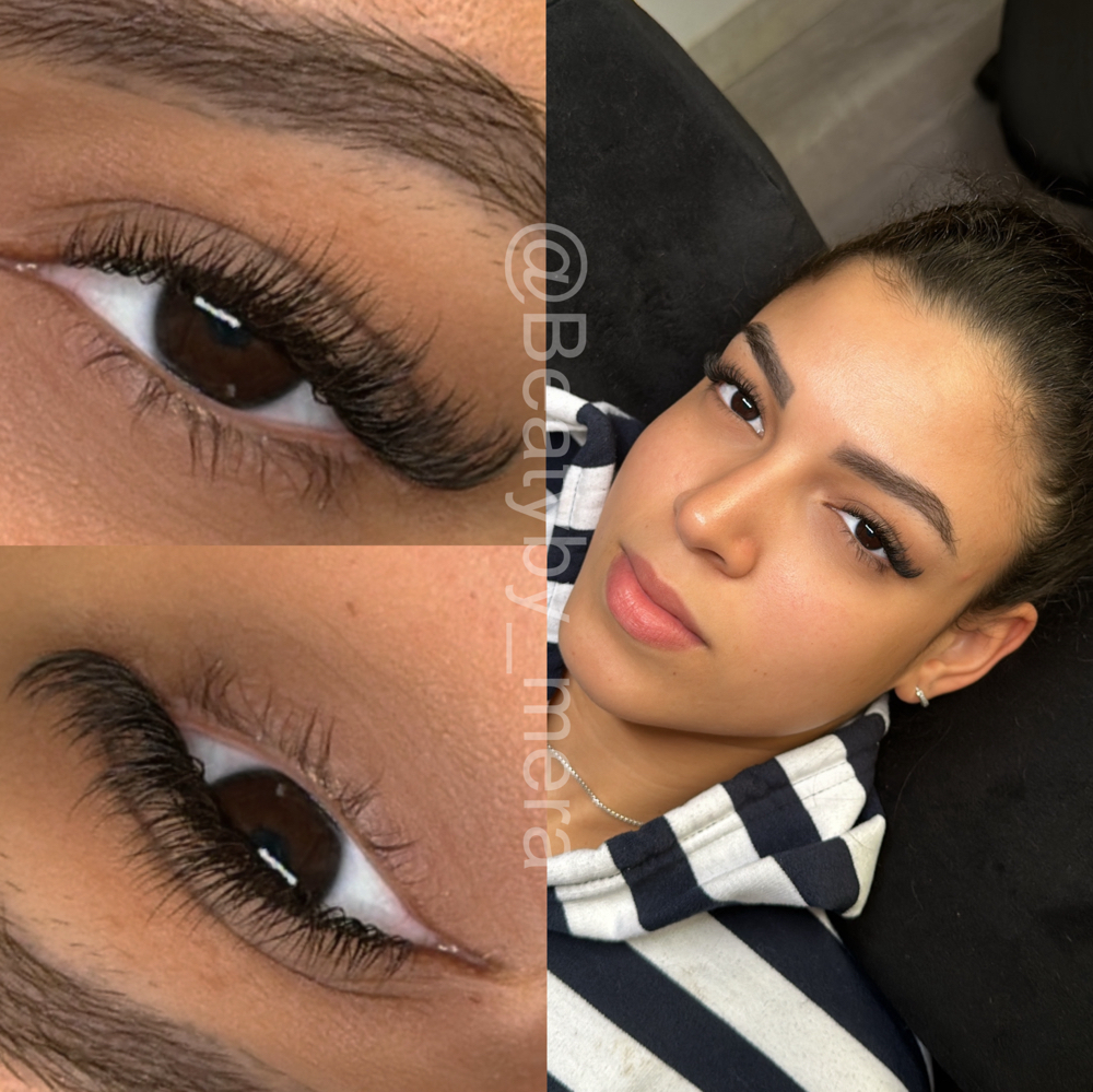 Classic Plus Fill (Retoque)