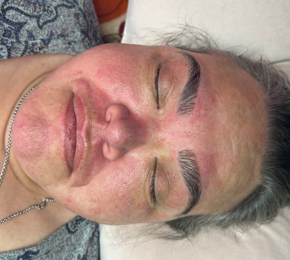 Full Face Wax - Includes Brows at WaxPlugLaura in Lincoln, NE