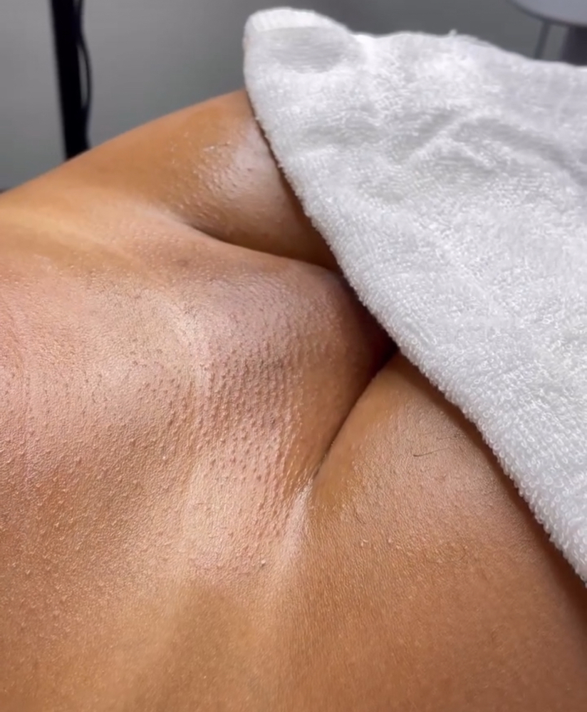 Full Brazilian Wax (V)