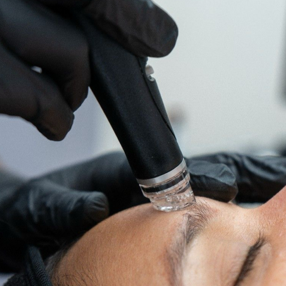 Hydro Glow Facial at Iconic Aesthetics in Palm Desert, CA