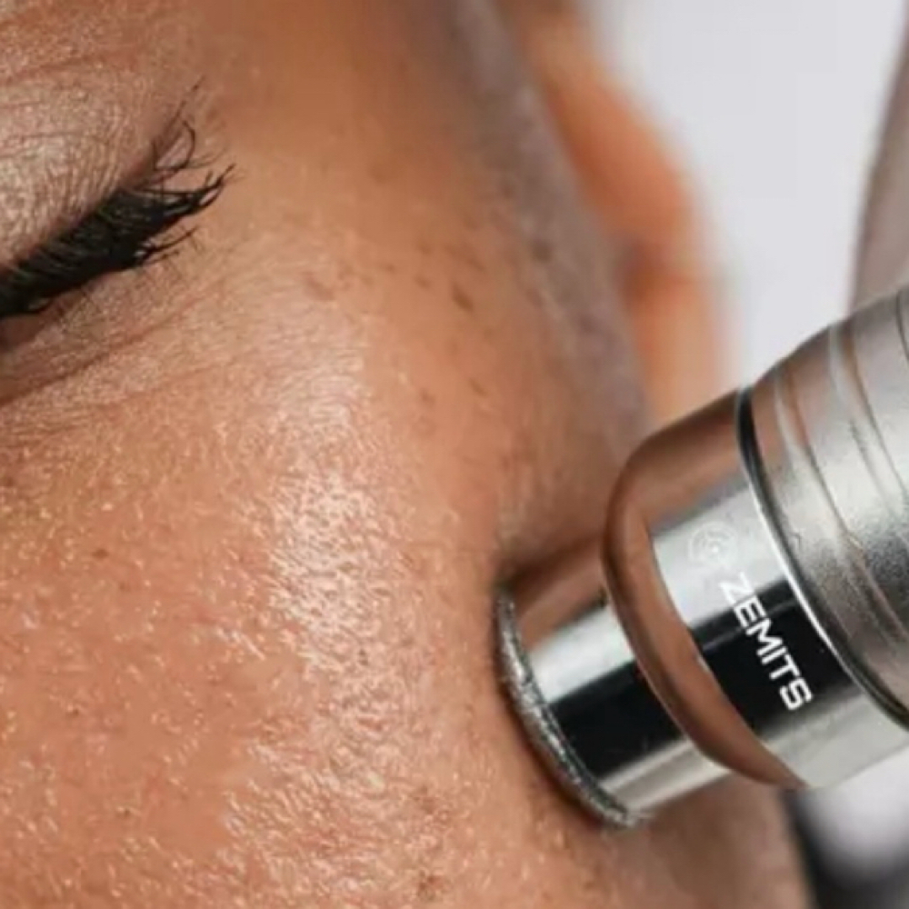 Microdermabrasion at Glow Getter a Spa Boutique in Waterford, CT