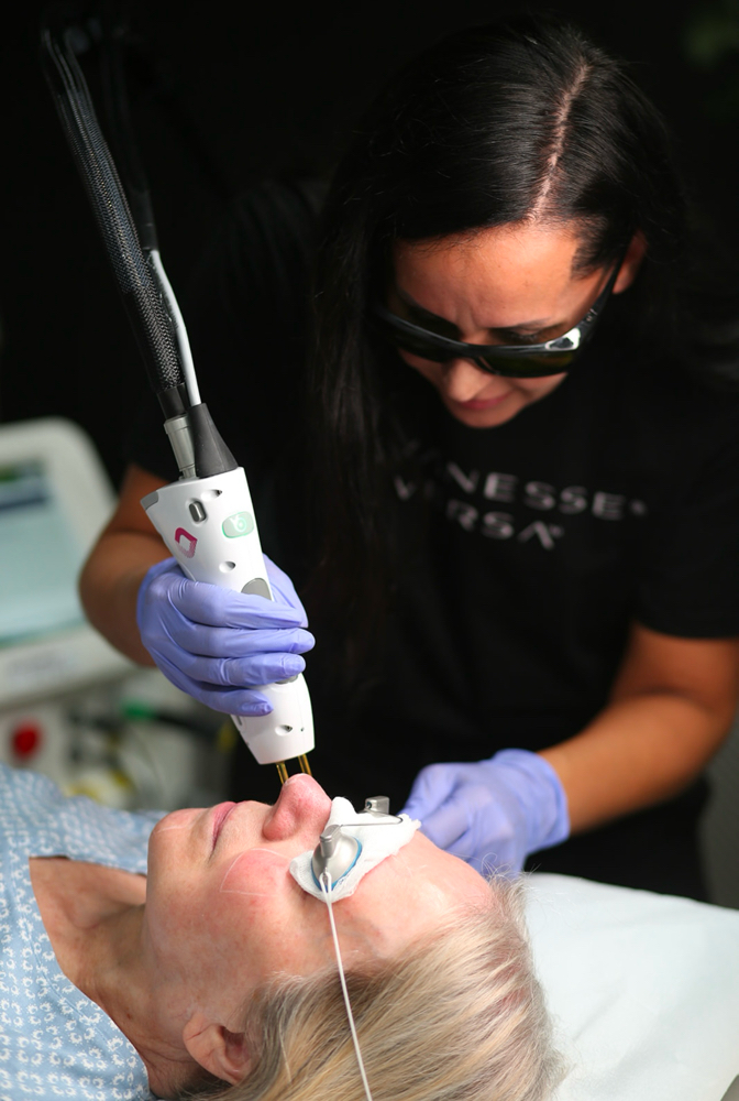 Laser Facial To Stimulate Collagen