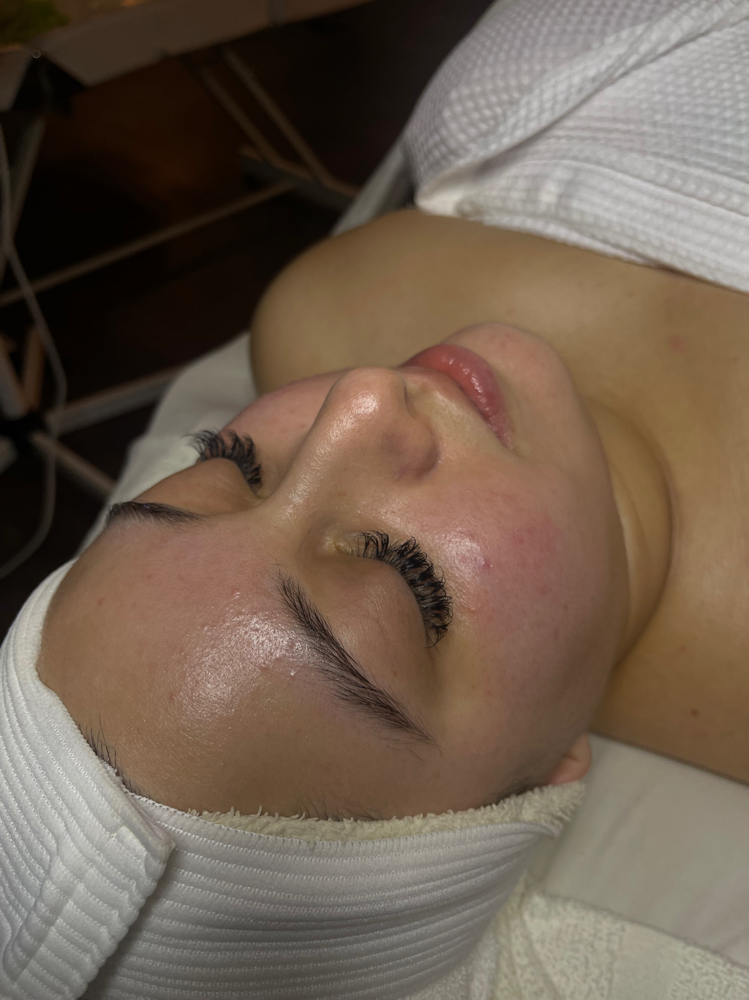 Classic Glow Facial✨