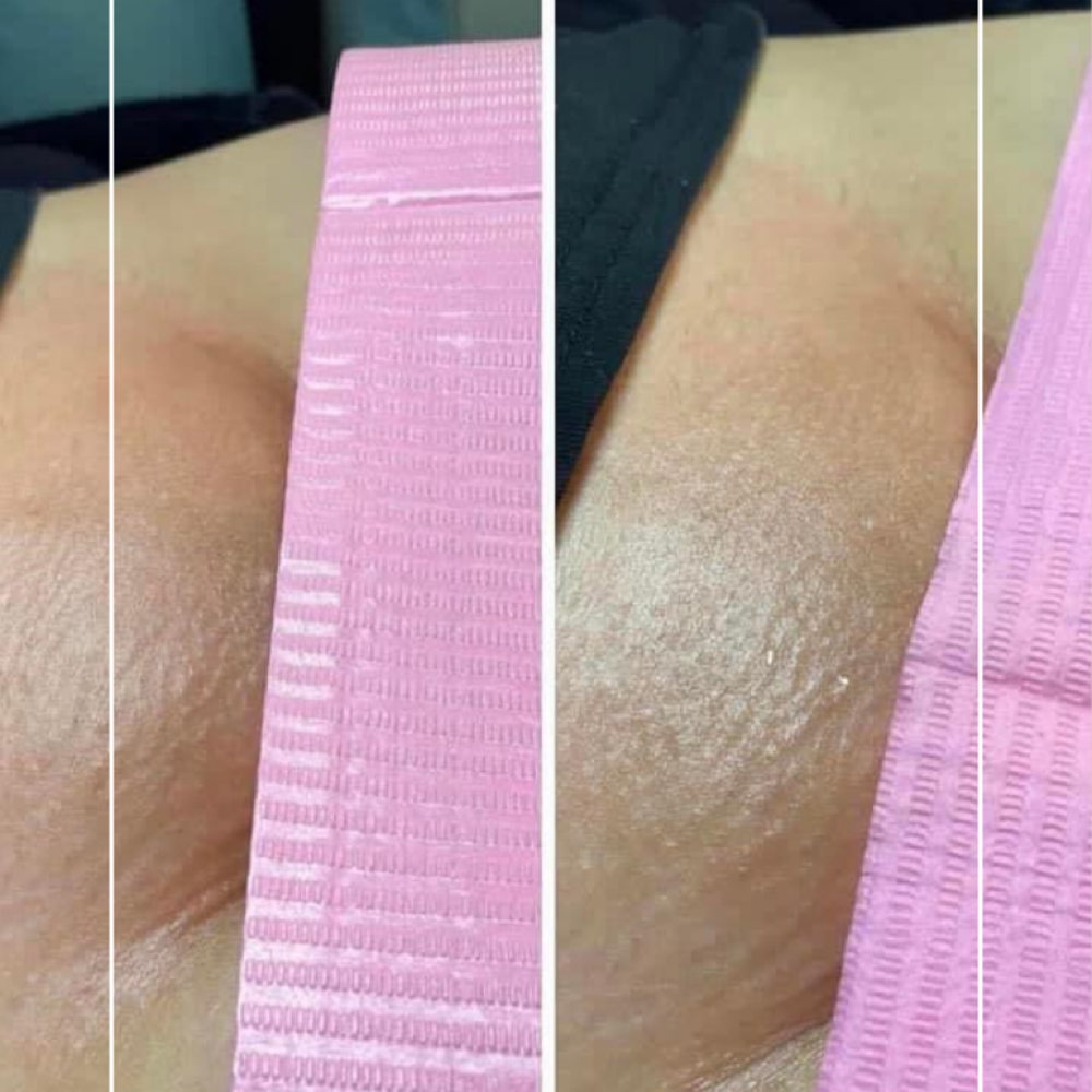 Brazilian Wax at Sweet Aesthetics by Alondra in McAllen, TX