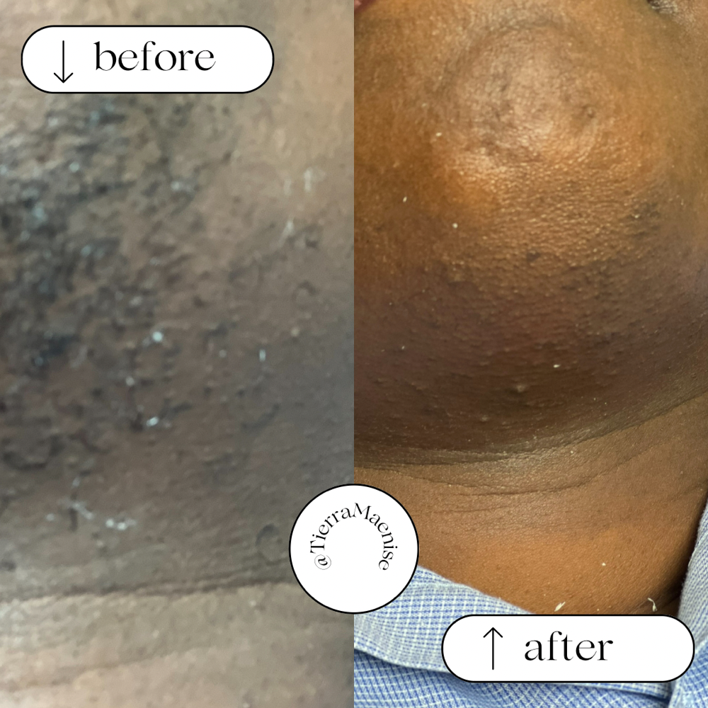 Chin Wax at Glam’d By Tierra Maenise in Kelford, NC
