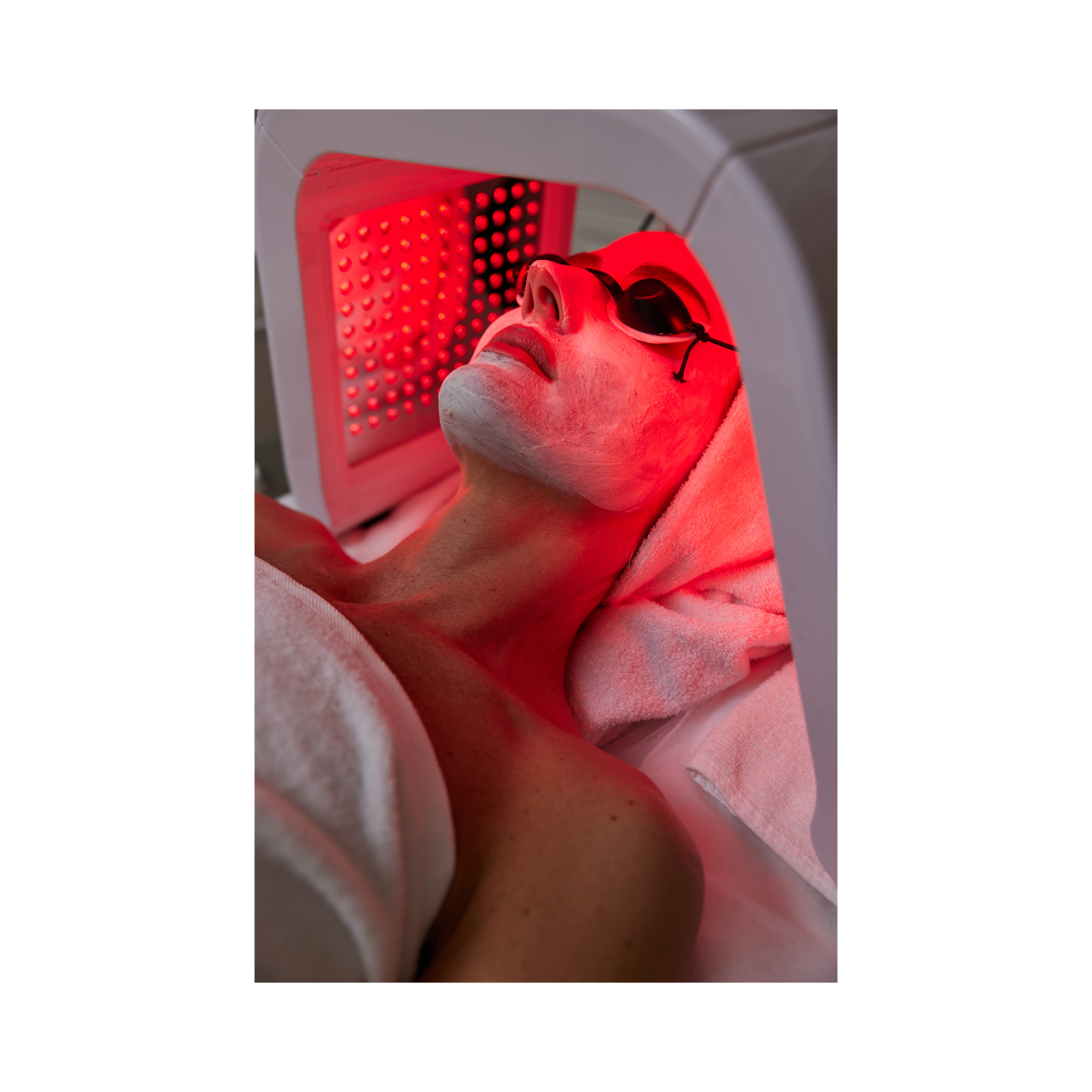 RED Light Therapy *Add On