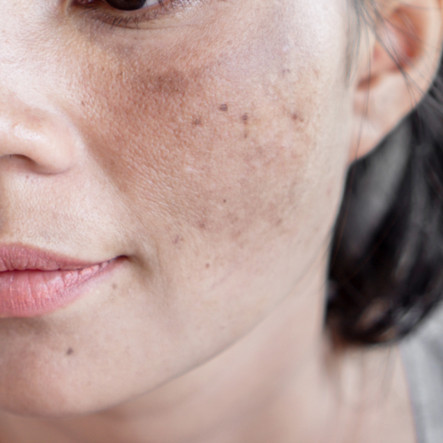 Specialized Care Dark Spots & Aging at Artemix Beauty & Medspa LLC in Tulsa, OK