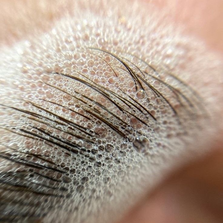 Brow Consultation