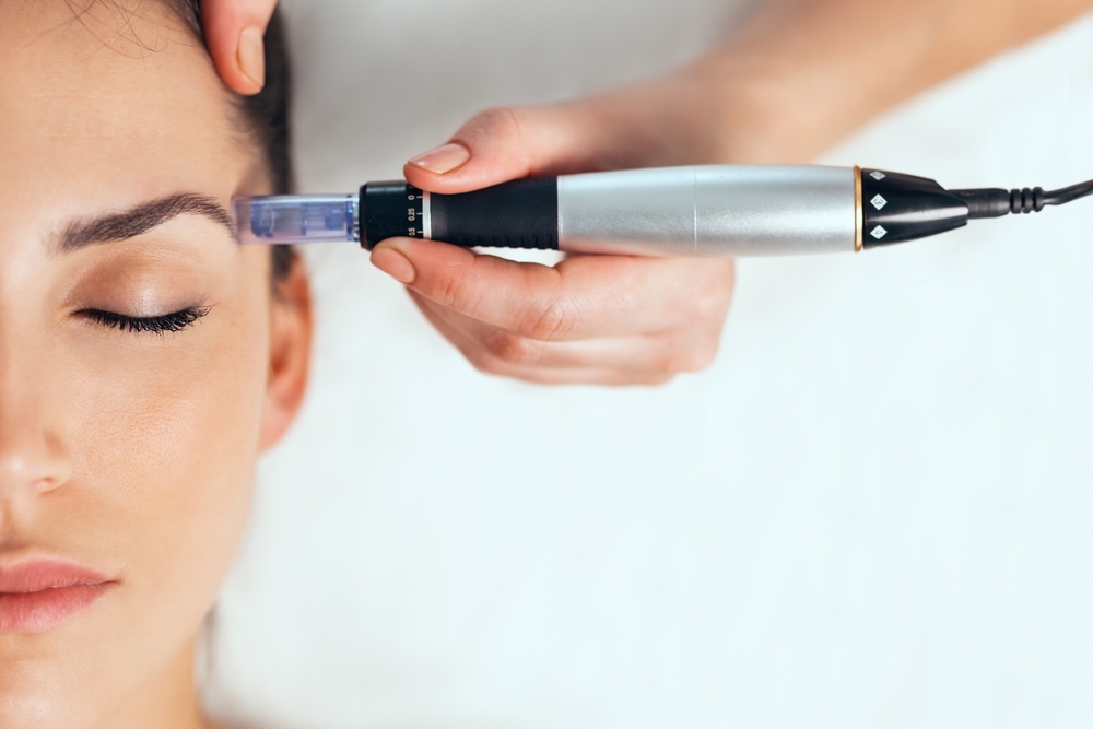PRP Microneedling(Vampire Facial) at Alabaster Beauty Co in Scottsdale, AZ