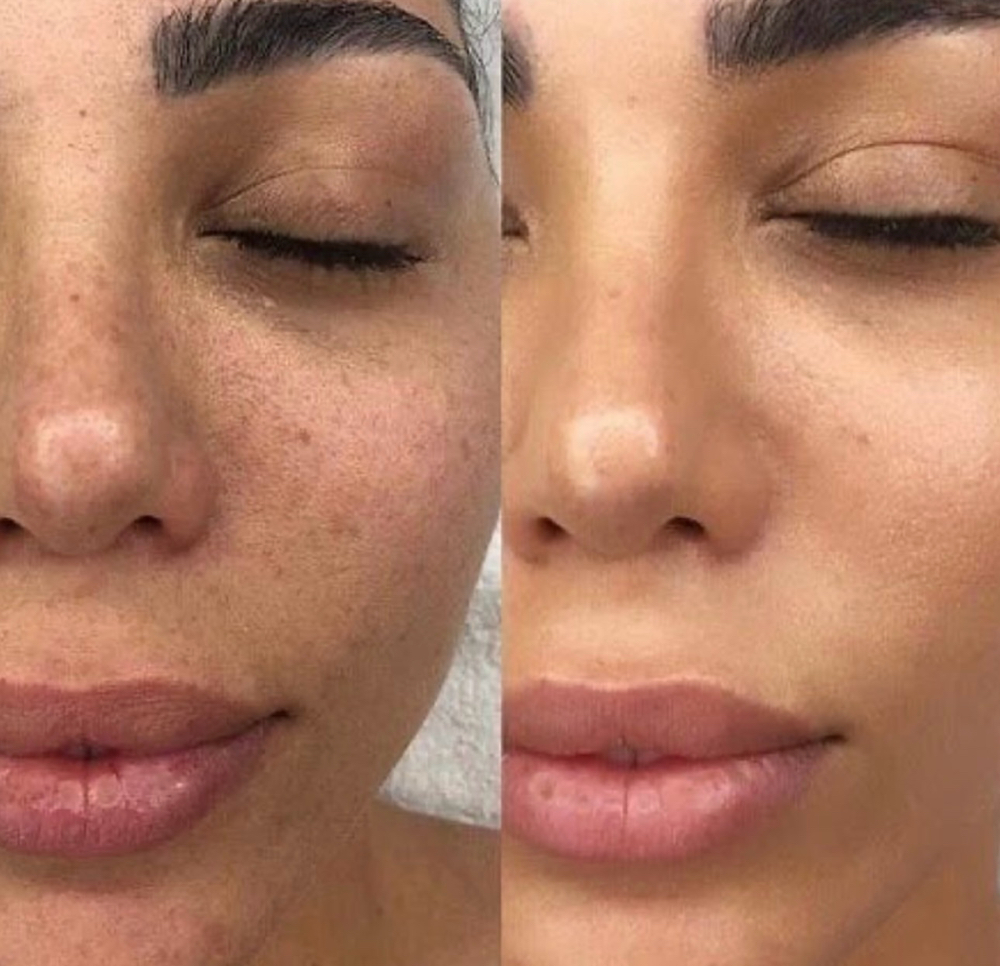 Semi Permanent Foundation