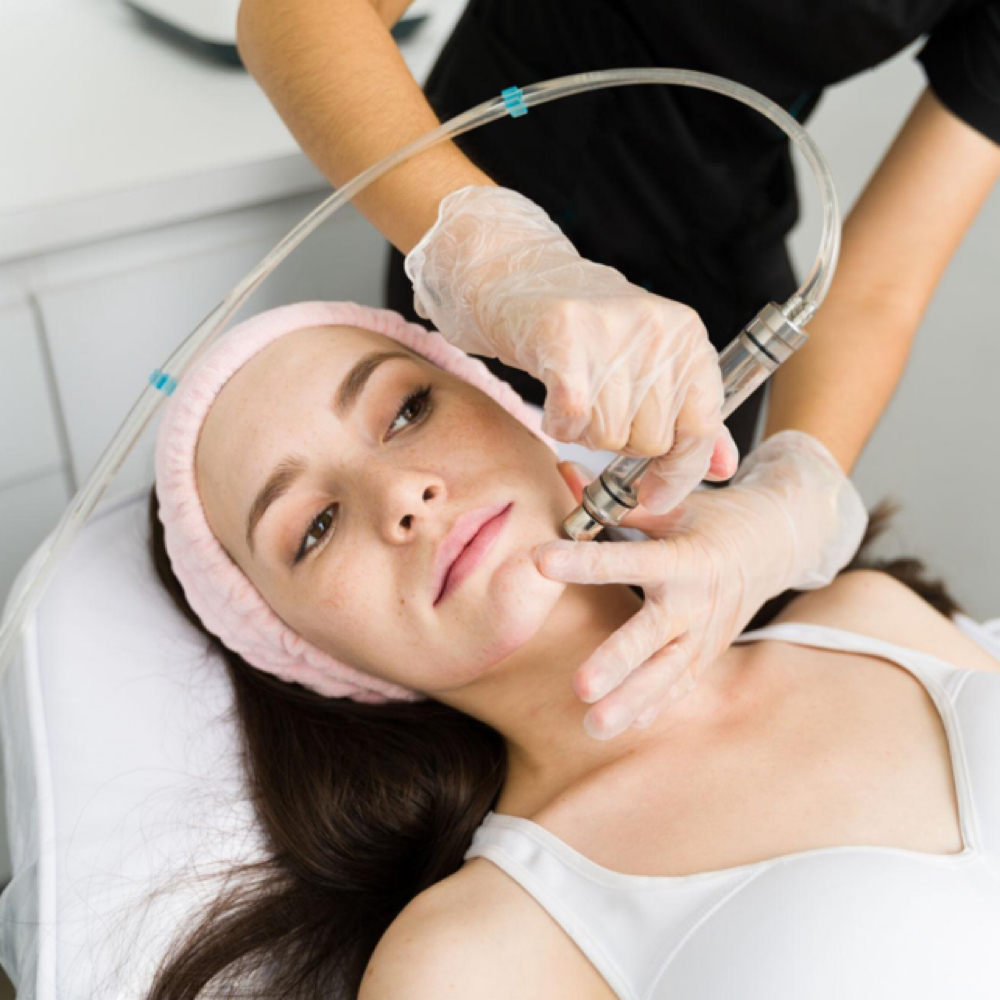 Add Ons | Microdermabrasion at Aura Atelier in Charlotte, NC