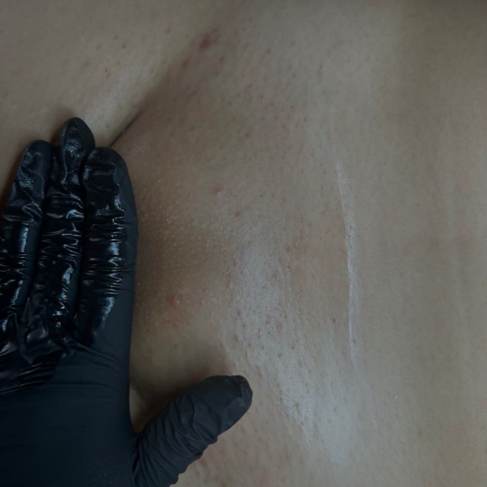 NEW CLIENT BRAZILIAN at BARESKINHAUS in Fremont, CA