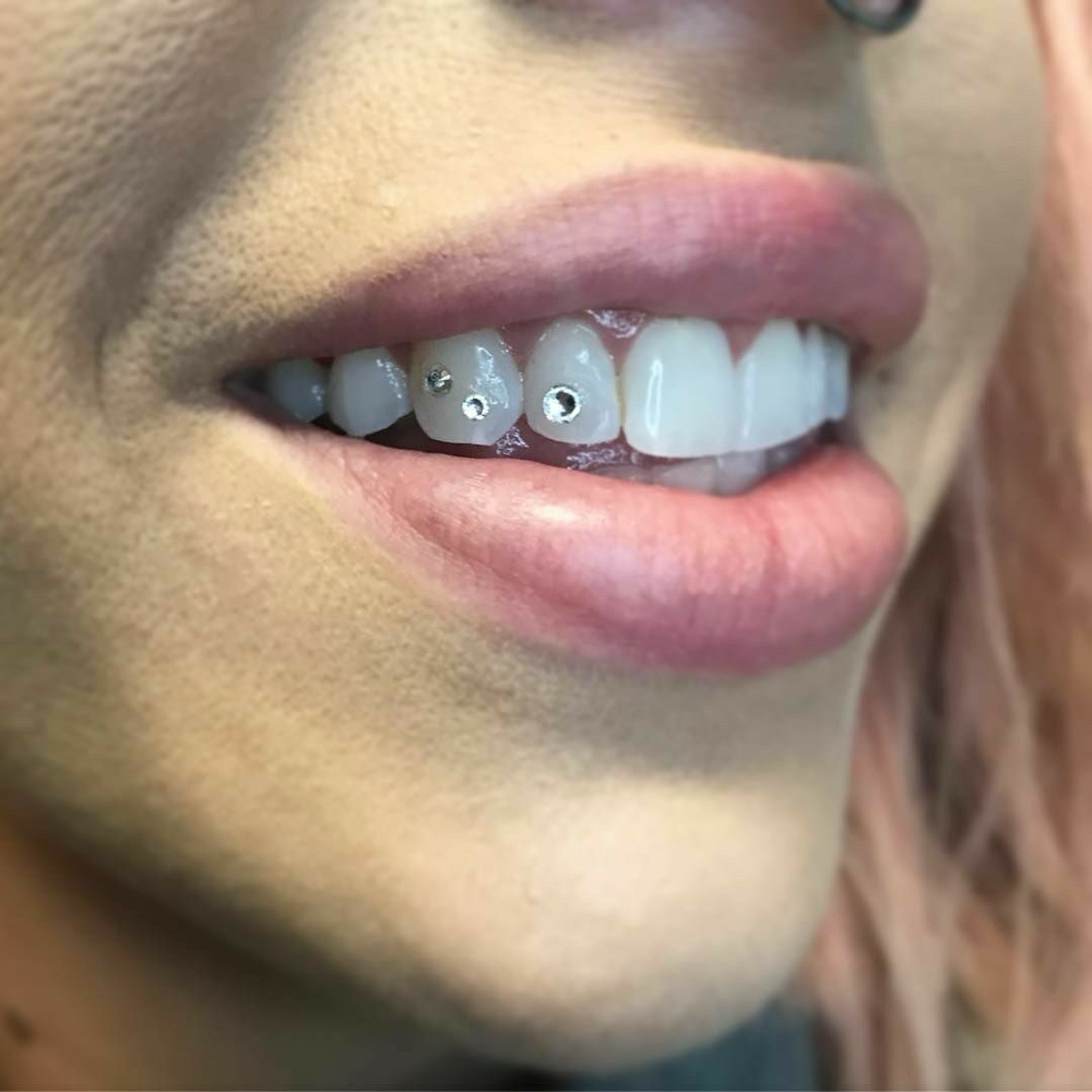 Tooth Gems