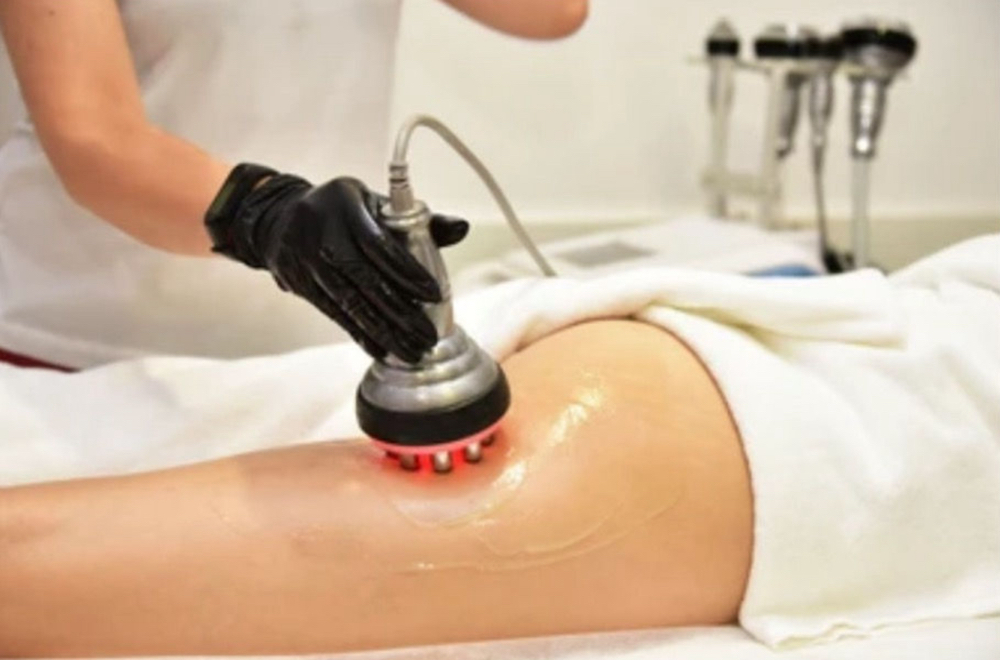 Skin Tightening