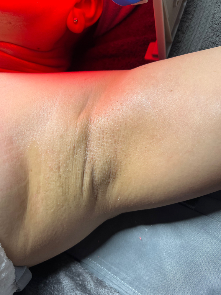 Under Arm Wax at Esthetics by bren in Poplar Grove, IL