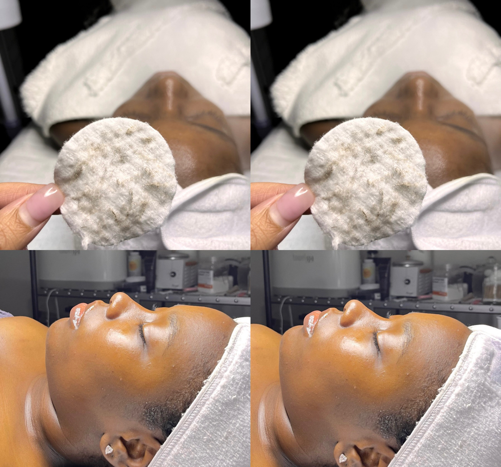 Mini Dermaplane Facial