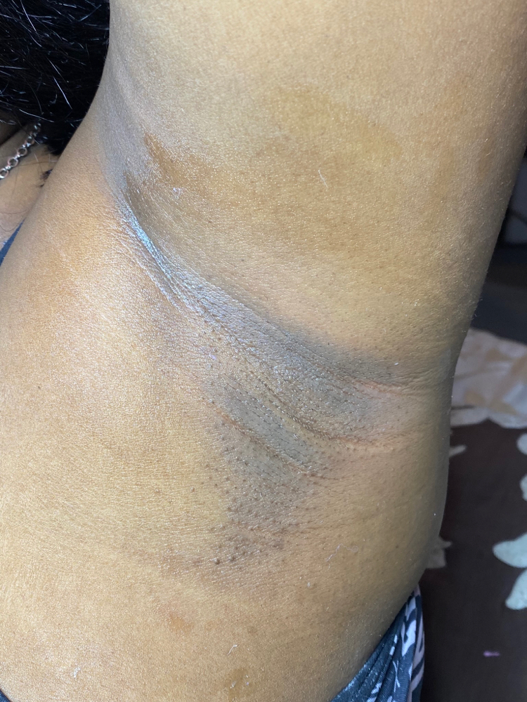 Underarm Wax