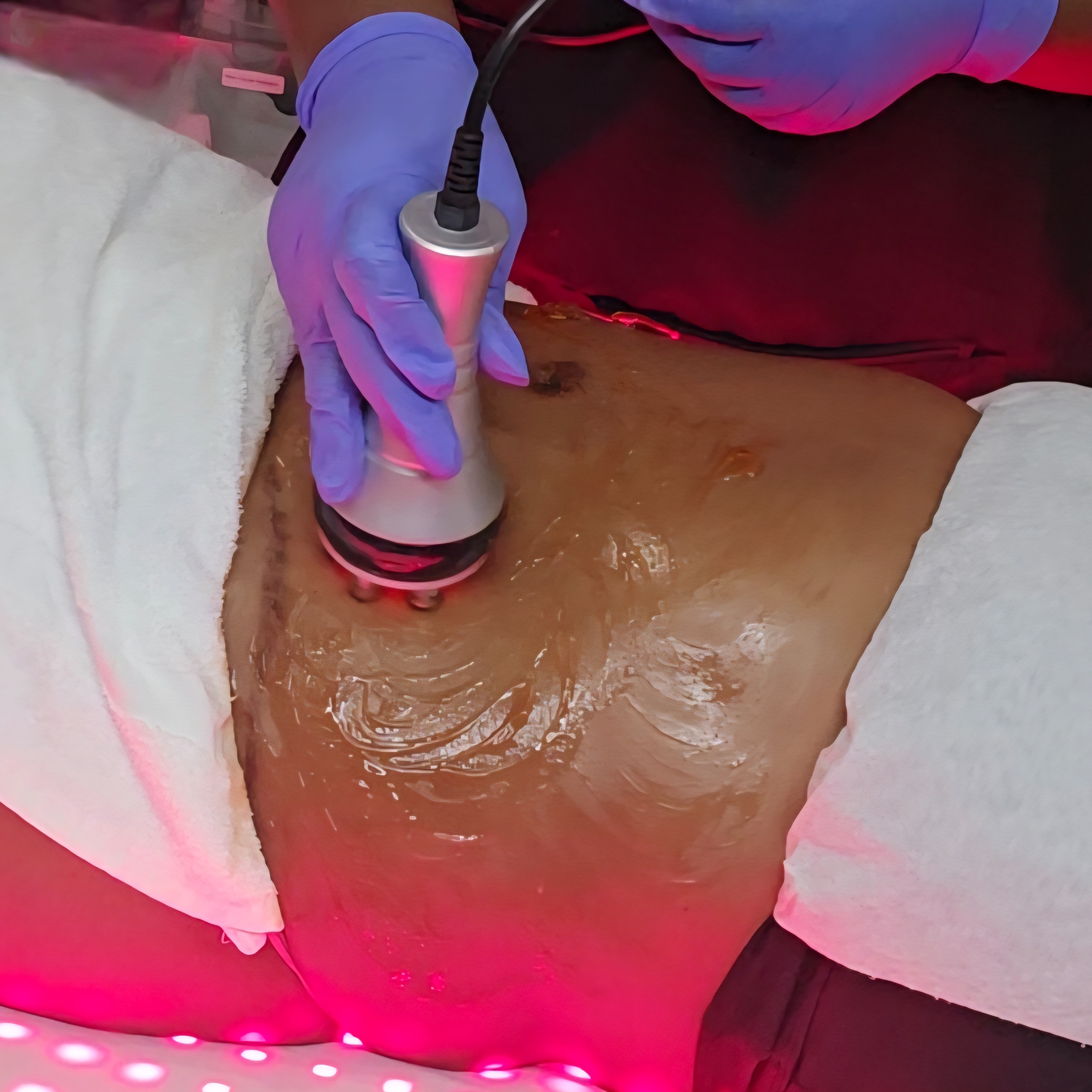 Tummy Sculpting Treatment at Powder Me_813 Spa & Beauty Services in Wesley Chapel, FL
