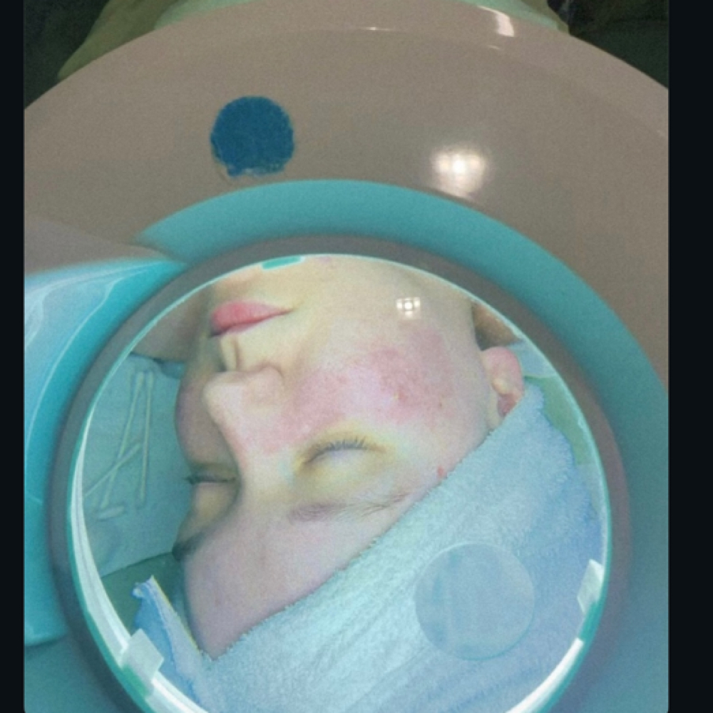 CRYO-GLOW THERAPY at The Lash & Beauty Lounge LLC in Pearland, TX