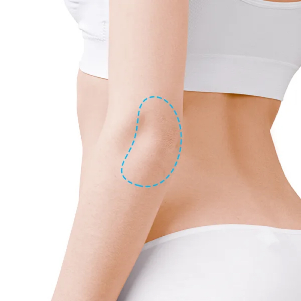 Elbows at Leidy Cornelio Spa in Aurora, CO