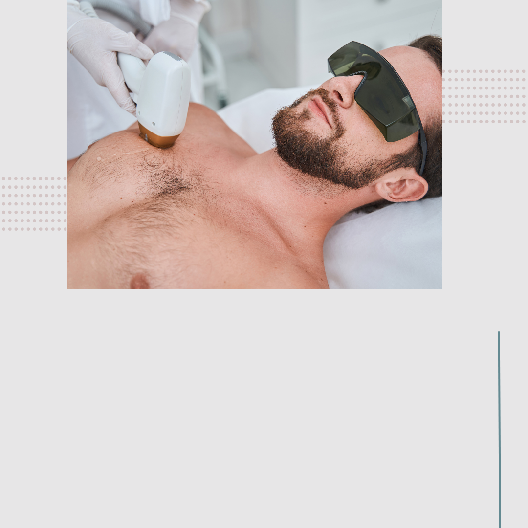 Laser Hair Removal - Torso