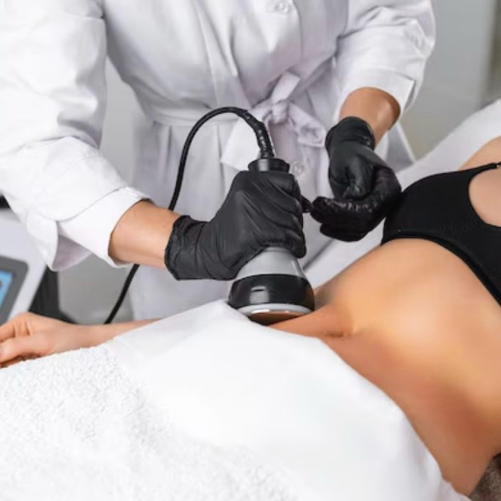 Body Sculpting- Single Session at Prism Beauty in San Juan Capistrano, CA