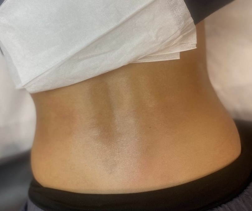 Lower Back Wax