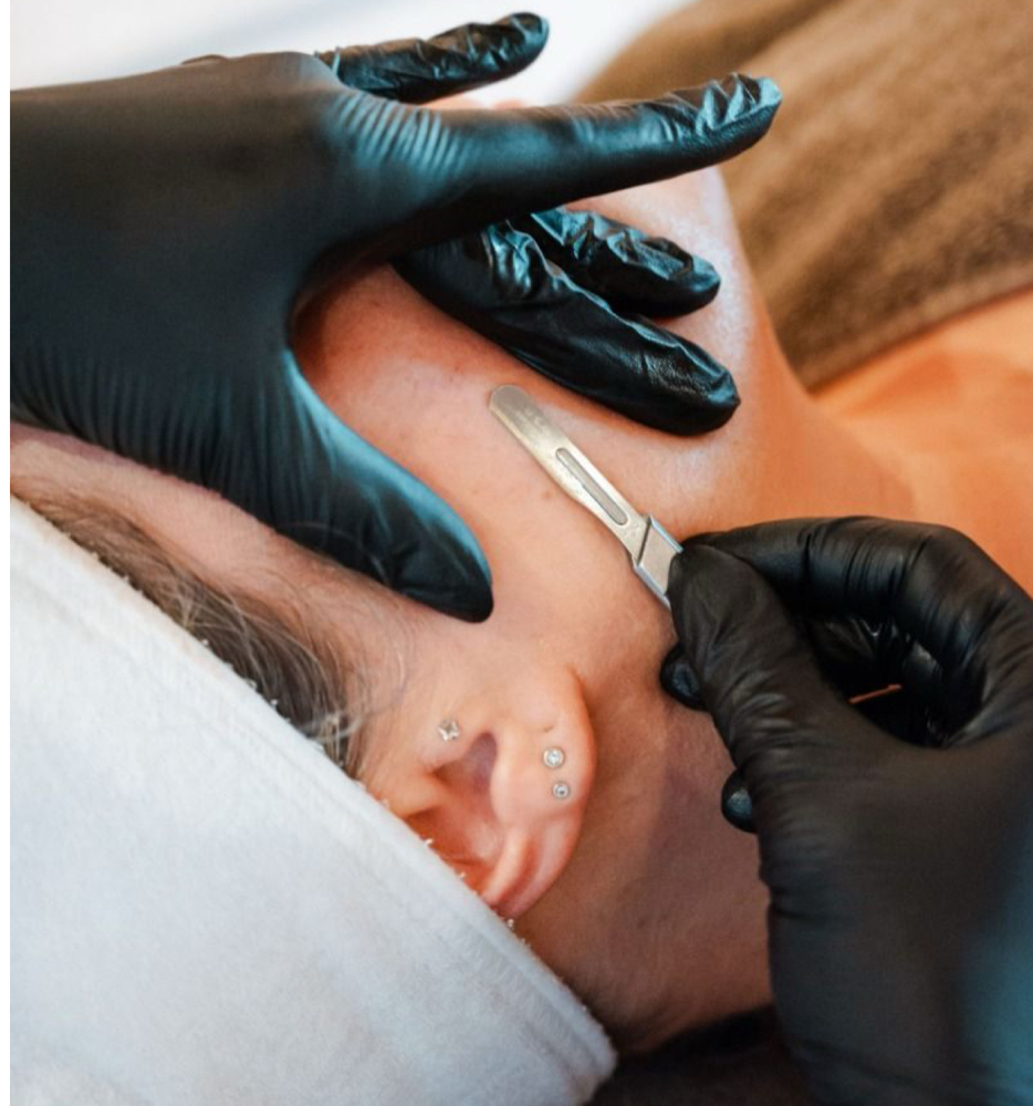 Just Dermaplaning