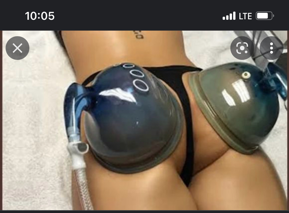 VACUUM THERAPY BBL